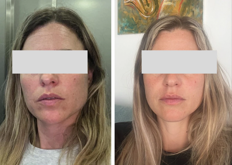 "הדרך לתוצאה זה שילוב של שגרה מדוייקת, התמדה ומעקב"