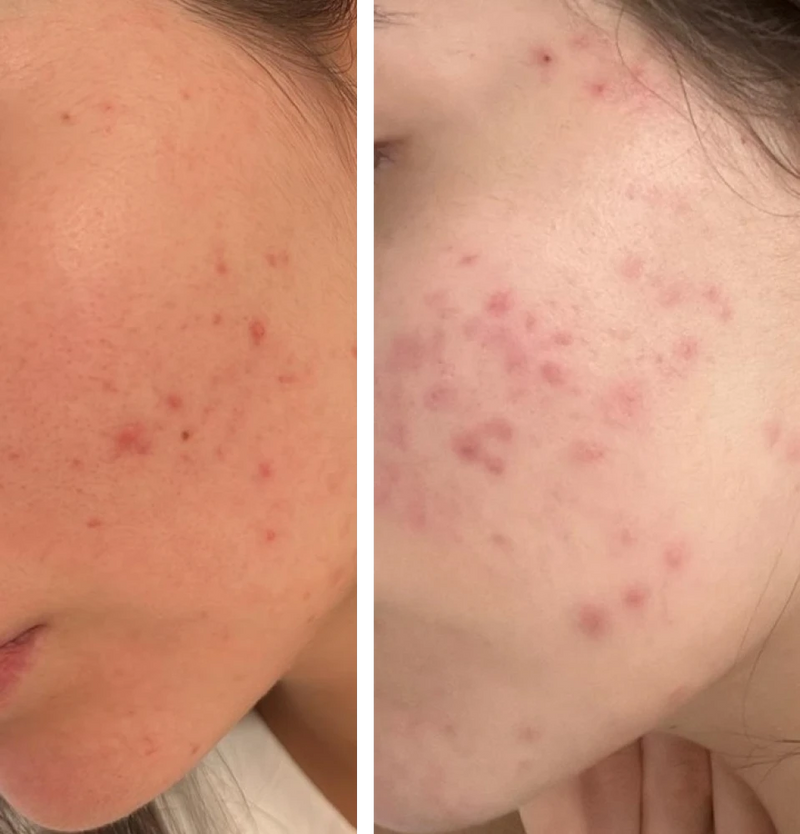 "הדרך לתוצאה זה שילוב של שגרה מדוייקת, התמדה ומעקב"