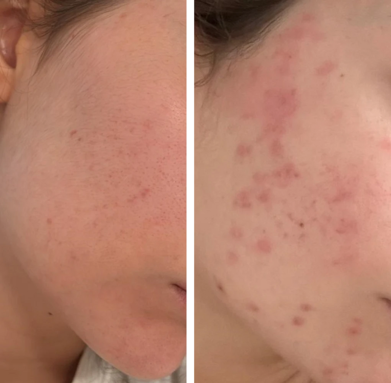 הדרך לתוצאה זה שילוב של שגרה מדויקת, התמדה ומעקב