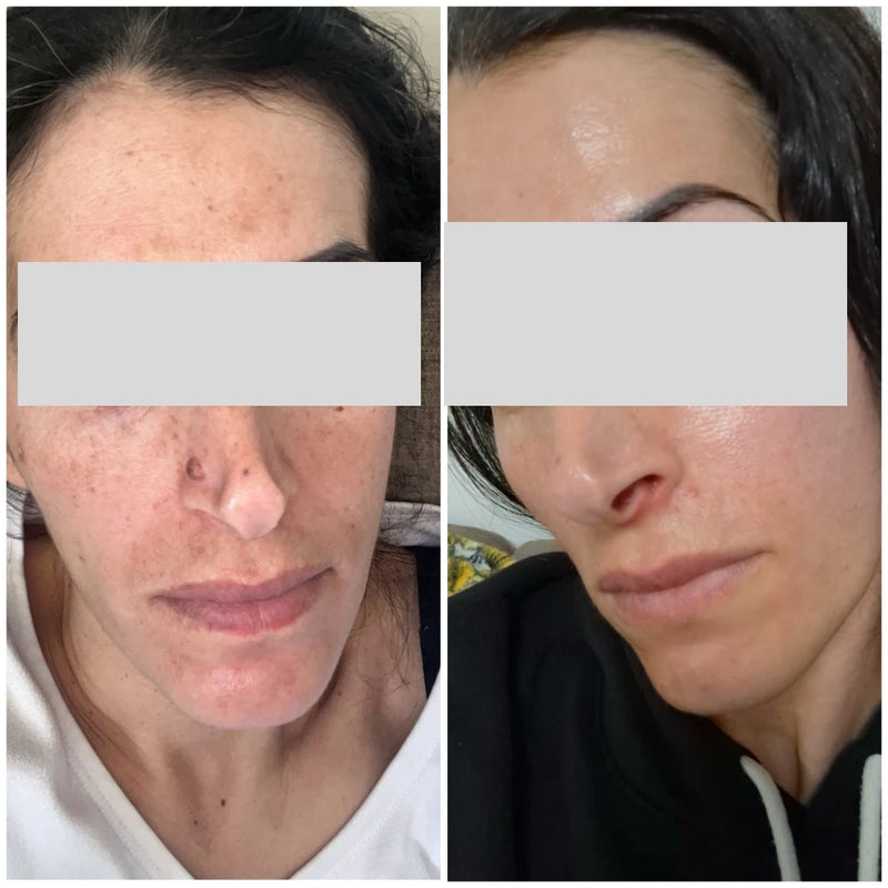 הדרך לתוצאה זה שילוב של שגרה מדויקת, התמדה ומעקב