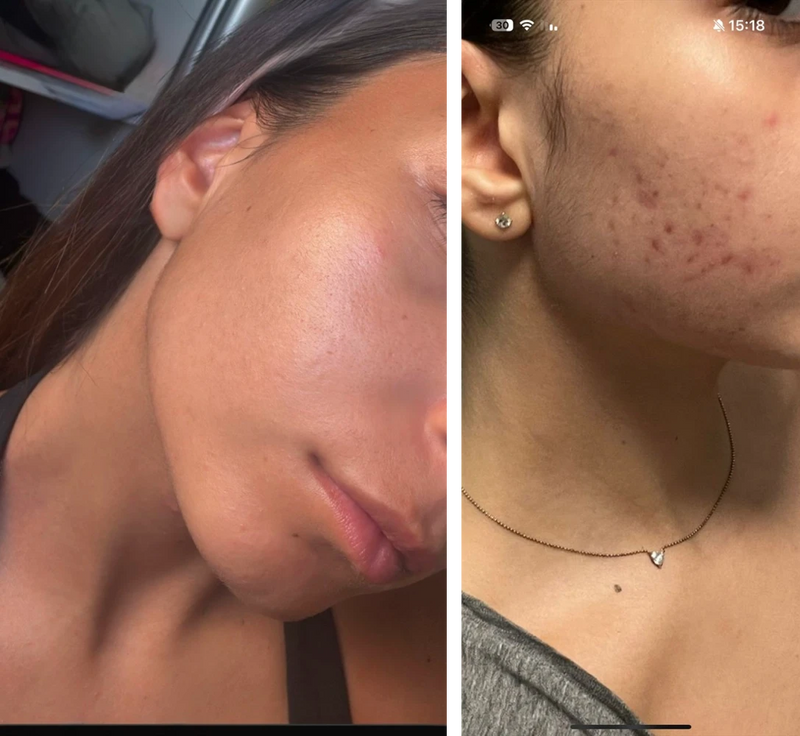 "הדרך לתוצאה זה שילוב של שגרה מדוייקת, התמדה ומעקב"