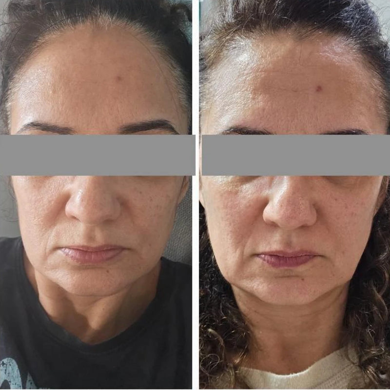 "הדרך לתוצאה זה שילוב של שגרה מדוייקת, התמדה ומעקב"