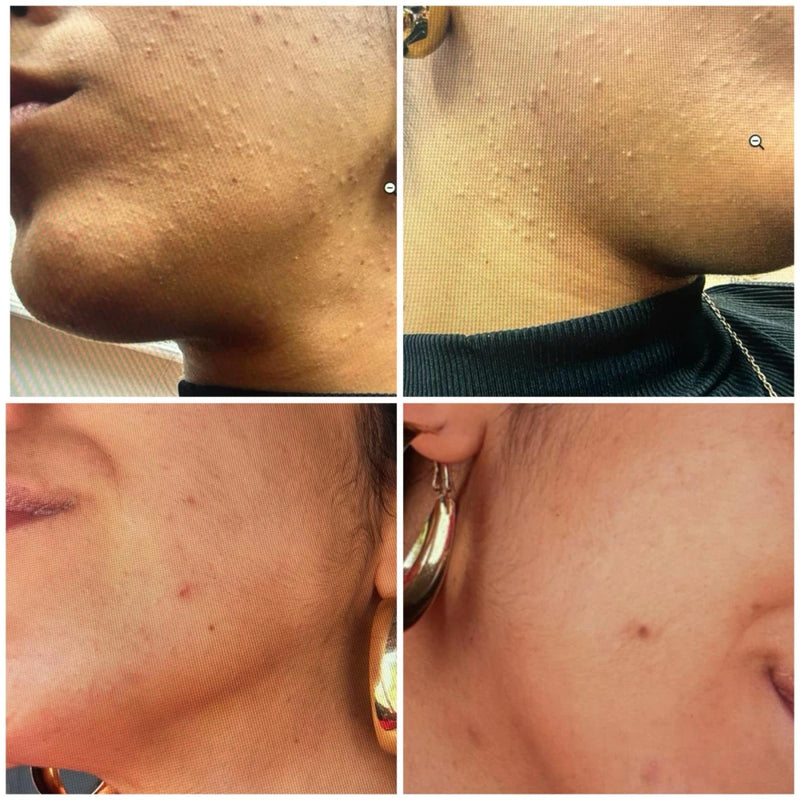 "הדרך לתוצאה זה שילוב של שגרה מדוייקת, התמדה ומעקב"