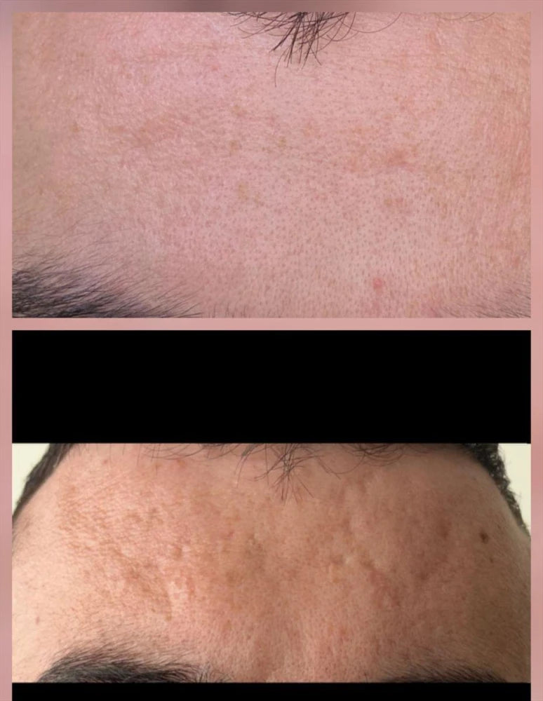 "הדרך לתוצאה זה שילוב של שגרה מדוייקת, התמדה ומעקב"