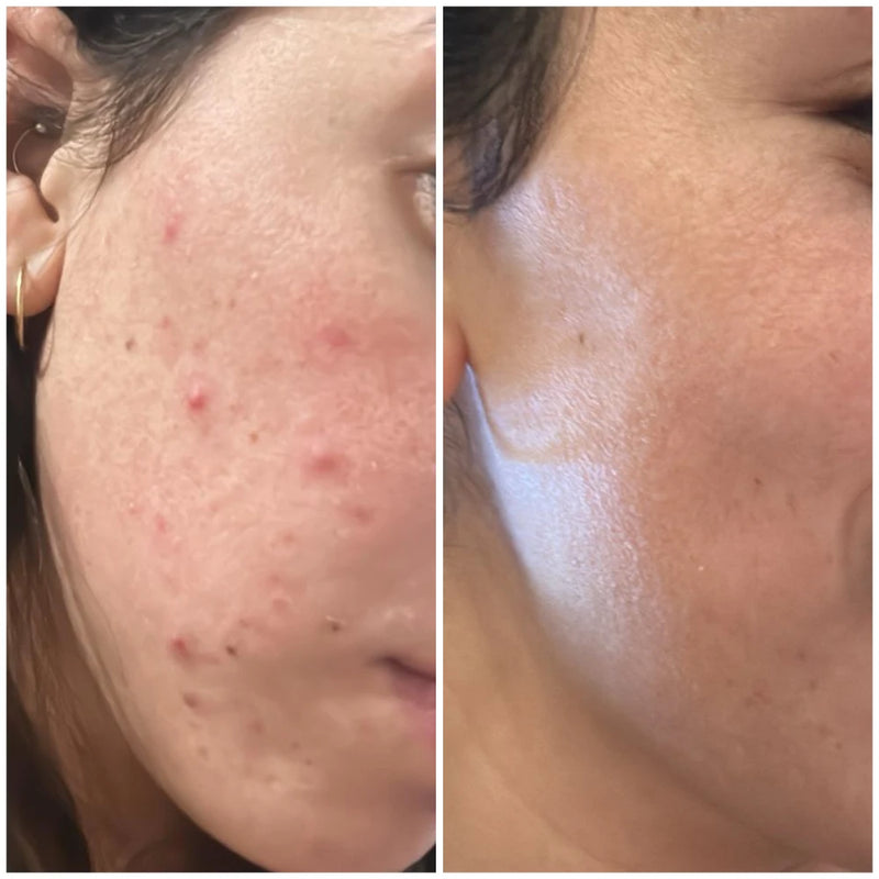 "הדרך לתוצאה זה שילוב של שגרה מדוייקת, התמדה ומעקב"