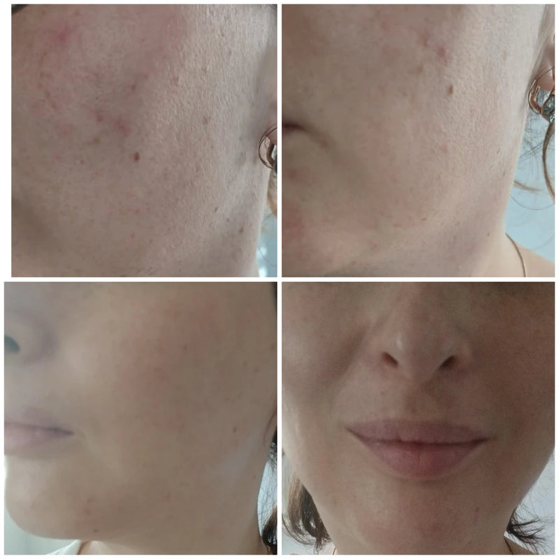 "הדרך לתוצאה זה שילוב של שגרה מדוייקת, התמדה ומעקב"